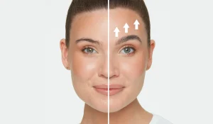 لیفتینگ ابرو : راهی برای بالا بردن و سفت کردن ابروها