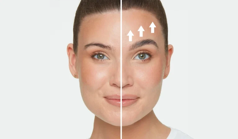لیفتینگ ابرو : راهی برای بالا بردن و سفت کردن ابروها
