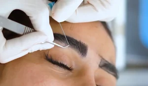 کاشت ابرو در تهران و سعادت آباد : کلینیک معتبر + عکس و فیلم