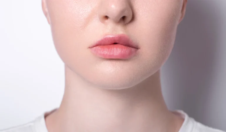 کجی لب بعد از تزریق ژل به چه دلایلی رخ می‌دهد؟