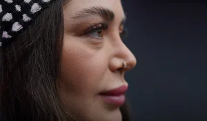 بهترین کلینیک رینوپلاستی در تهران و سعادت آباد + عکس و فیلم