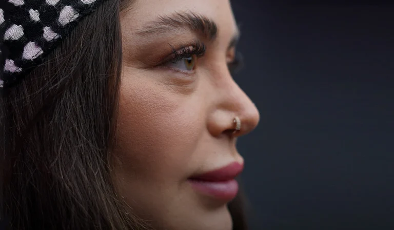 بهترین کلینیک رینوپلاستی در تهران و سعادت آباد + عکس و فیلم