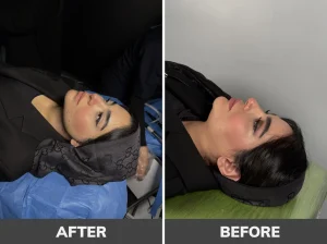 بهترین کلینیک لیپوساکشن غبغب در تهران