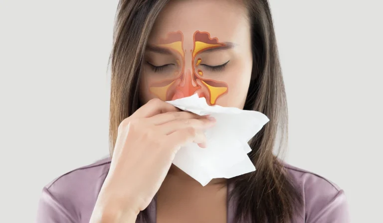 فین کردن بعد از عمل بینی : خطرناک است؟
