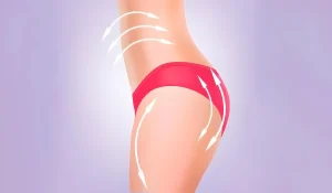 لیپوساکشن ران، ساق و مچ پا : رفع چاقی موضعی این نواحی بدن