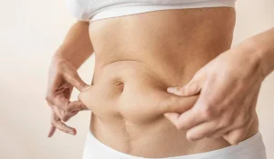 لیفت شکم : کشیدن و سفت کردن پوست آویزان شده شکم