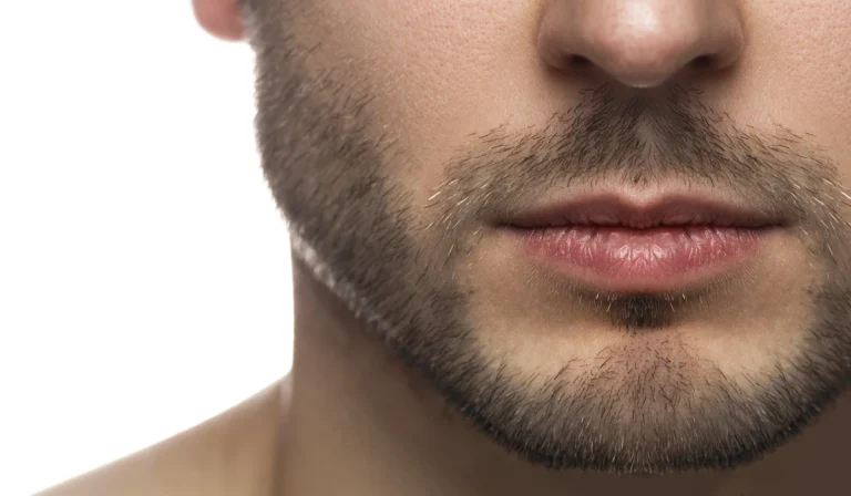 ۱۵ روش ایجاد زاویه فک در مردان : در خانه یا با روشهای جراحی‌