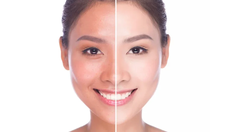 16 کرم برای روشن‌ شدن پوست صورت : معرفی بهترینهای ایرانی و خارجی