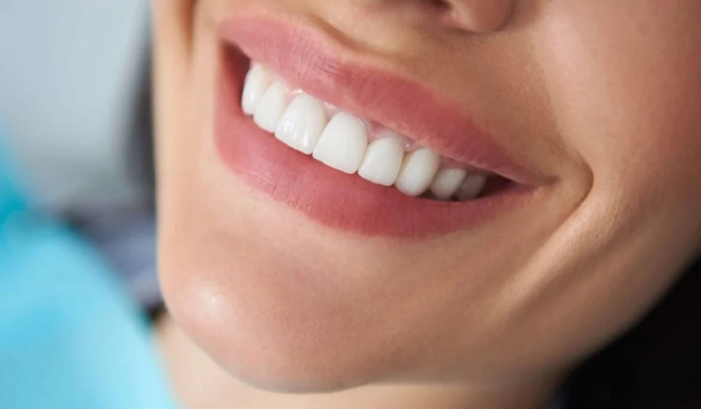 ۲۰ مدل پرطرفدار کامپوزیت دندان : از طبیعی تا فانتزی