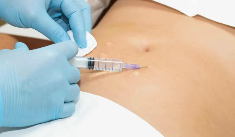 مزوتراپی شکم : حذف چربی‌های موضعی بدون جراحی