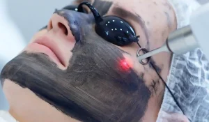 کربن تراپی صورت : راز پوست شفاف، بدون لک و جوان با لیزر کربنی