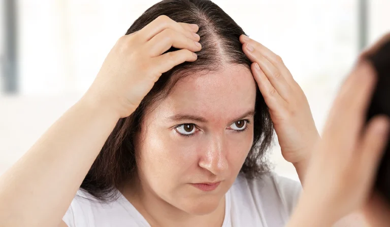 علت ریزش مو در زنان بالای ۴۰ سال : چرا با افزایش سن، موها کم‌پشت می‌شوند؟