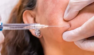 عوارض تزریق ژل به صورت و بدن در کنار تاثیر چشمگیر زیبایی