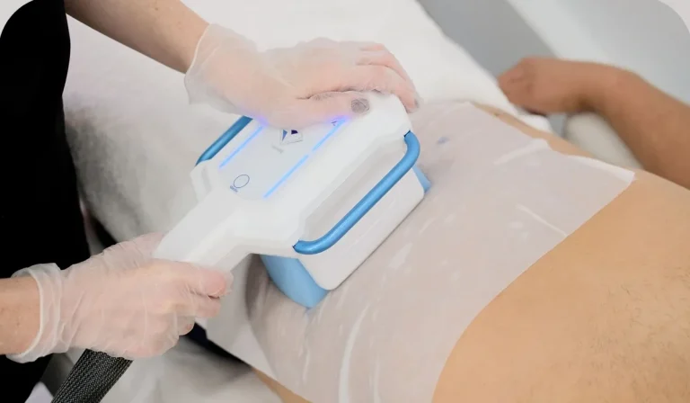 دستگاه کرایولیپولیز نسل چهارم (CoolTech Define)