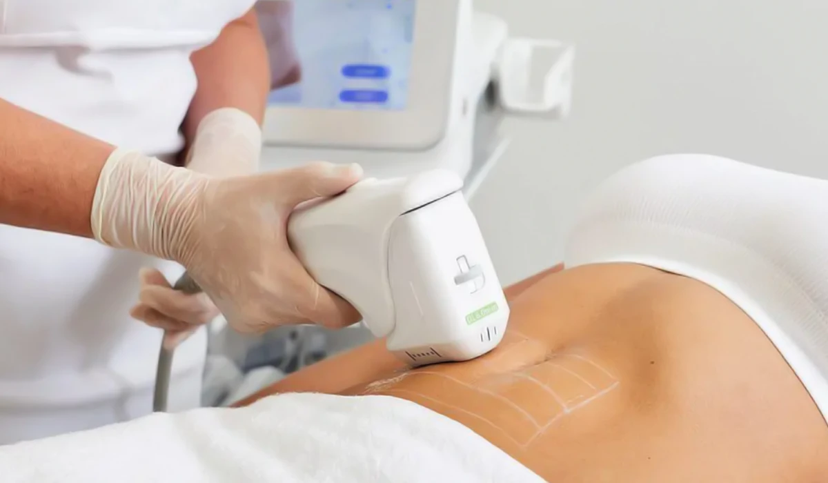 هایفولیپولیز (HIFU Body Slim 4D)