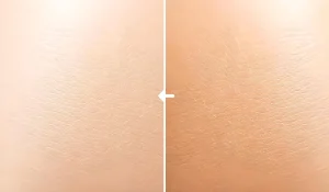 سفید کردن پوست بدن : چرا بسیاری افراد به دنبال آن هستند؟