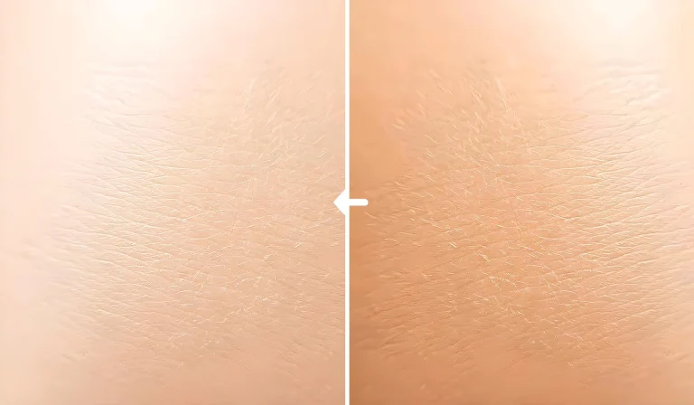 سفید کردن پوست بدن : چرا بسیاری افراد به دنبال آن هستند؟