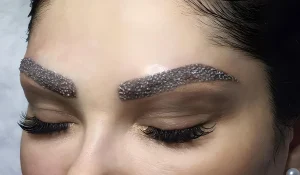 سیخ شدن ابرو بعد از کاشت : چرا اتفاق میافتد و چطور کنترل میشود؟