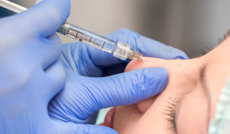 تزریق ژل به نوک بینی : اصلاح فرم بینی بدون تیغ و در ۱۵ دقیقه