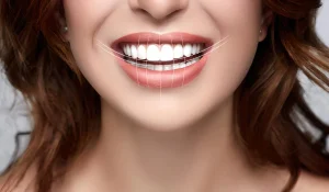 لبخند هالیوودی : هنر لبخند بینقص و زیبایی دندان