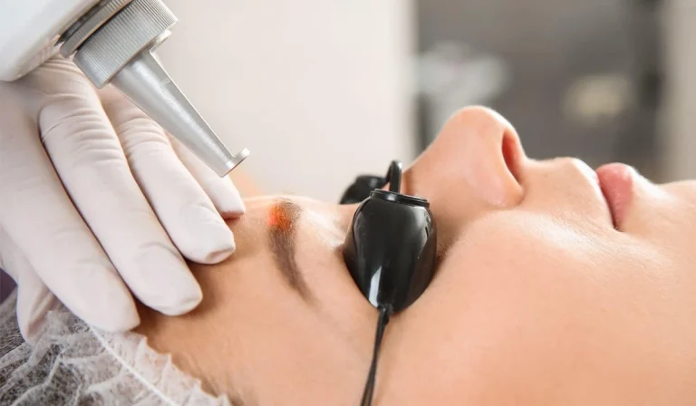 لیزر تاتوی ابرو : بعد از لیزر می‌توان کاشت ابرو انجام داد؟