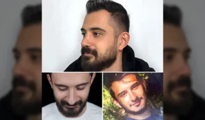 جراحی بینی مردانه و طبیعی : چرا بینی آقایان طبیعی بهتر است؟