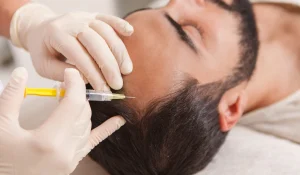 مزوتراپی بعد از کاشت مو : تقویت فولیکولها و ماندگاری نتایج