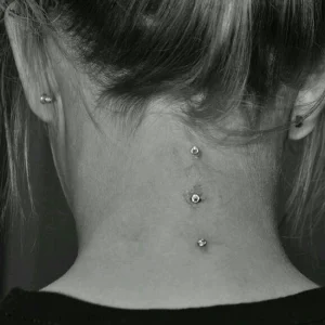 میکرودرمال گردن