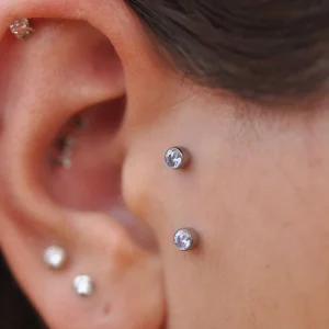 میکرودرمال جلوی گوش