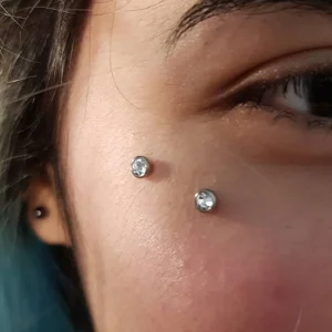 میکرودرمال روی گونه