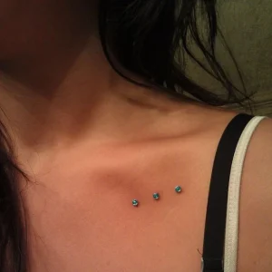 میکرودرمال ترقوه