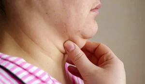 چربی سوز قوی برای غبغب یا همان چربی زیر چانه بدون جراحی