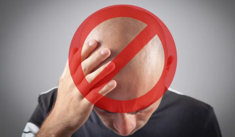 ممنوعیت‌های بعد از کاشت مو : چرا مواردی را باید رعایت کنیم؟