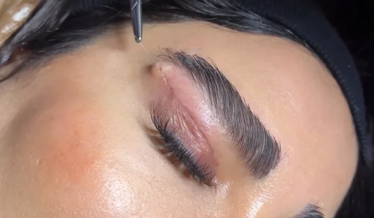 درمان جای بخیه بعد از بلفاروپلاستی : برای ترمیم سریع چه کنیم؟