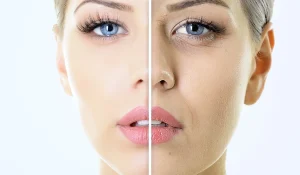 انواع مزوژل : جوانسازی پوست با تکنولوژی مزوتراپی و ژل