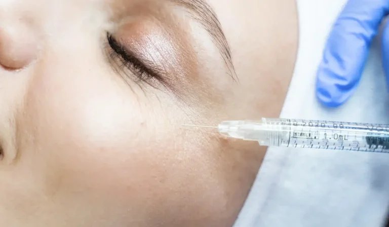 مزوتراپی زیر چشم : برای رفع تیرگی، گودی و مشکلات این ناحیه