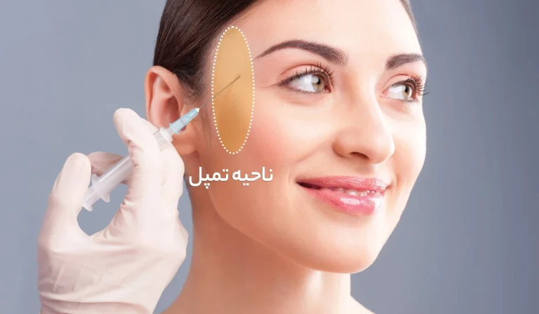 تمپل صورت : آشنایی با این ناحیه و اهمیت آن در زیبایی چهره
