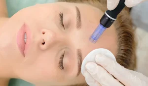 مزوتراپی صورت در خانه : آیا واقعا ممکن و موثر است؟