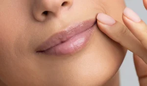 سانترال لب پایین : نقش این عمل در زیبایی لبها