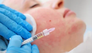 انواع پروفایلو : کدام نوع برای پوست شما مناسب است؟