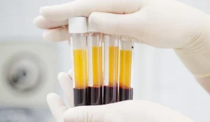 پی آر پی (PRP) : جوانسازی پوست و مو با پلاسمای خود فرد