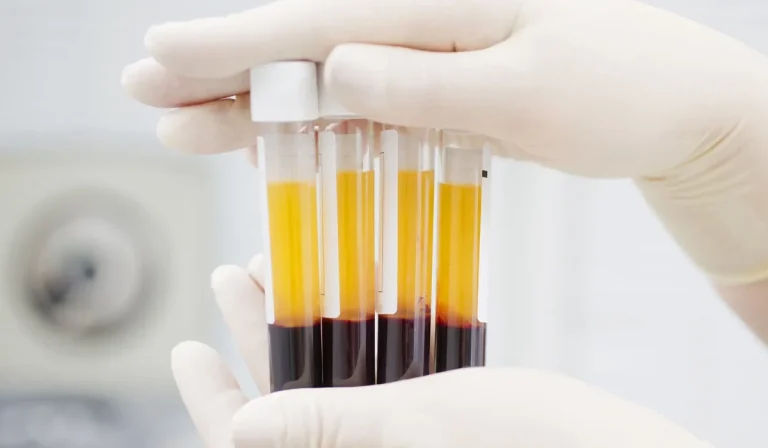 پی آر پی (PRP) : جوانسازی پوست و مو با پلاسمای خود فرد