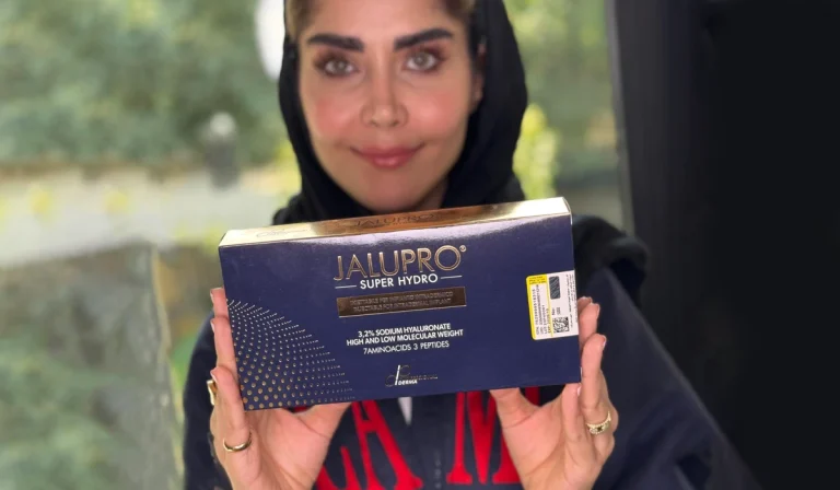 jalpero2